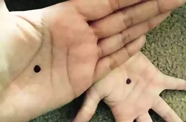 Black-dot-campaign.jpg