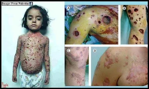 gazaandwhitephosphorus.jpg