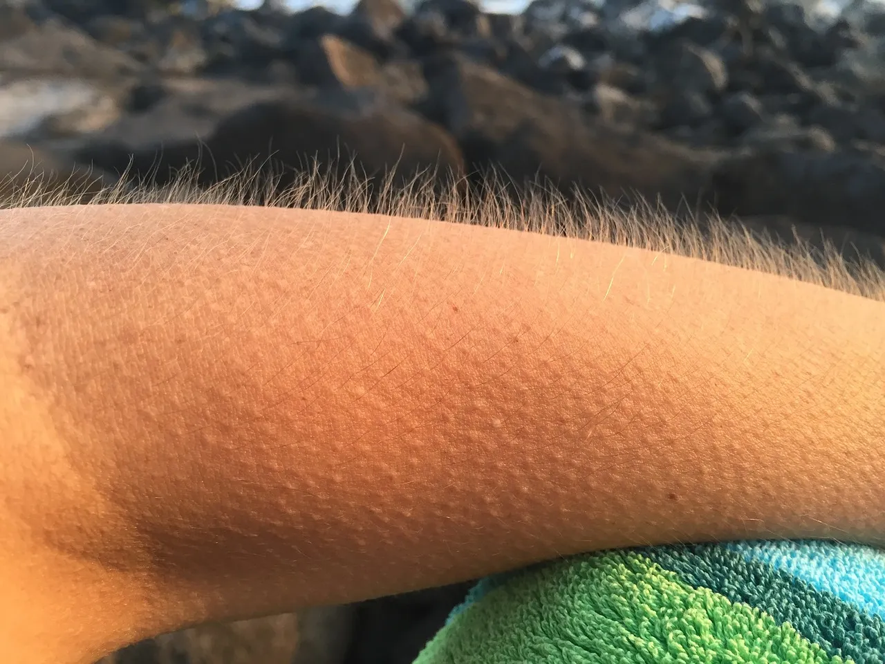 goosebumps-885563_1280.jpg