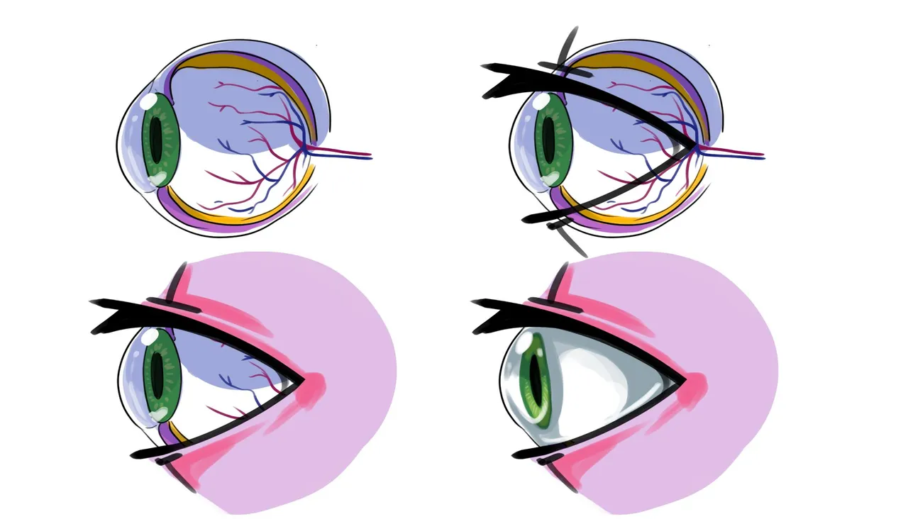 ojo perfil parpado.jpg