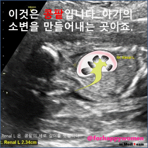 크기변환_슬라이드8.GIF