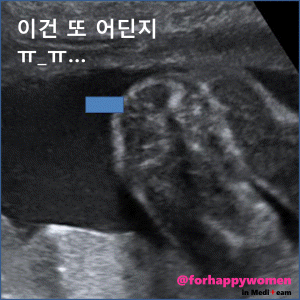 크기변환_슬라이드9.GIF