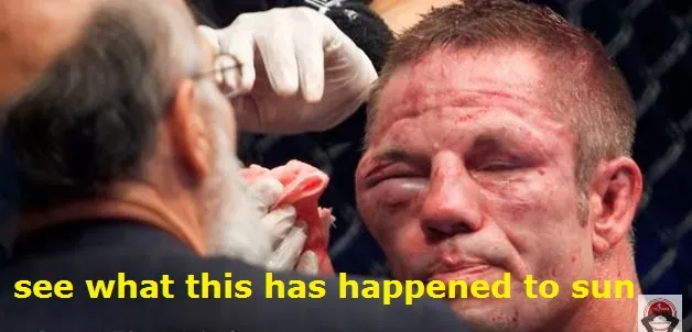 after the fight face spoil sun.jpg