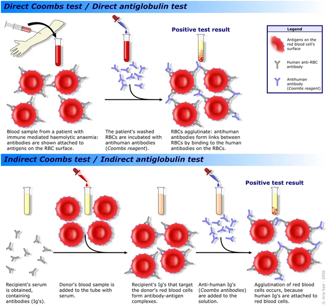 641px-Coombs_test_schematic.png