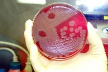 Anthrax 1.jpg