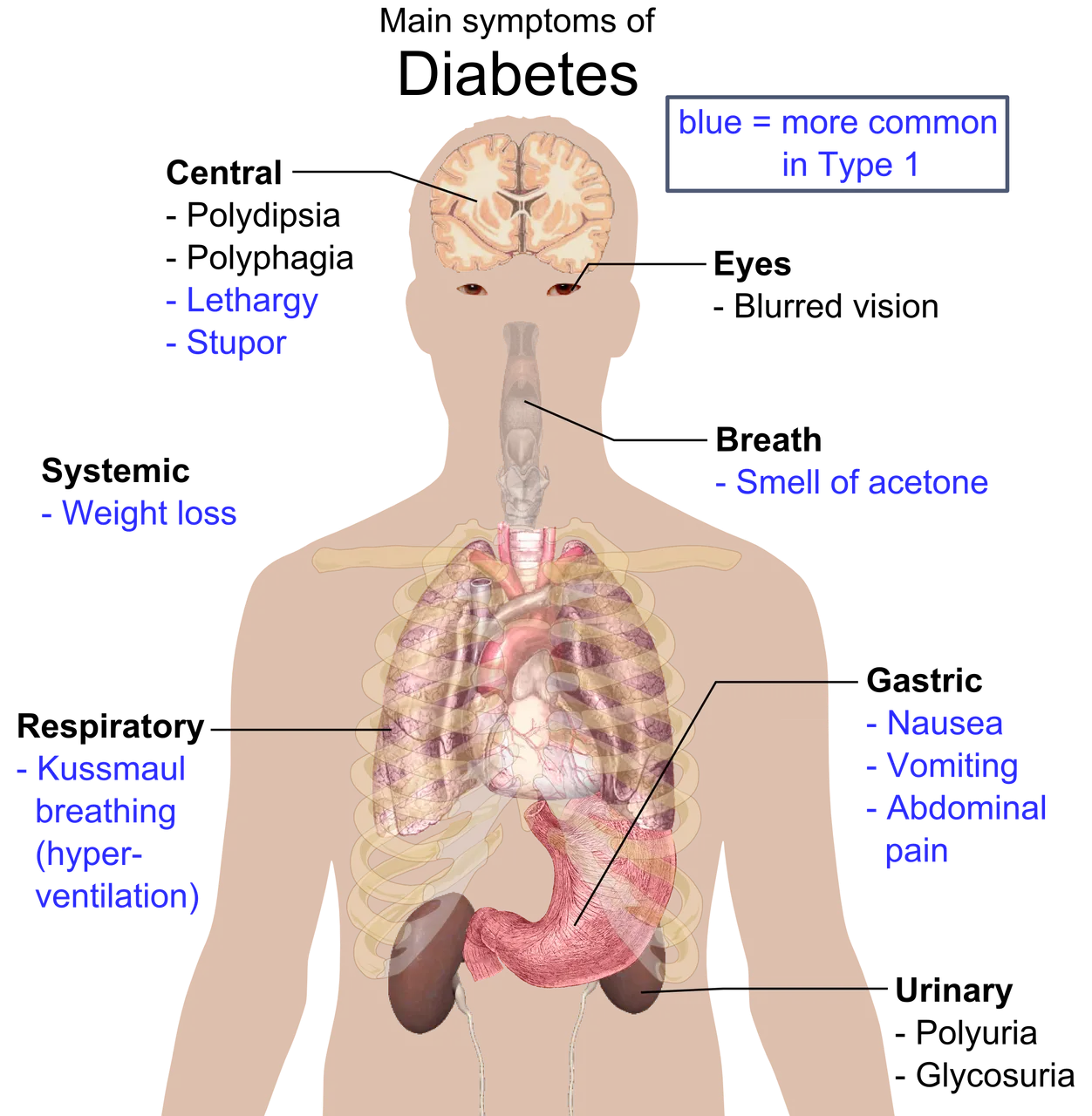 Main_symptoms_of_diabetes (1).png