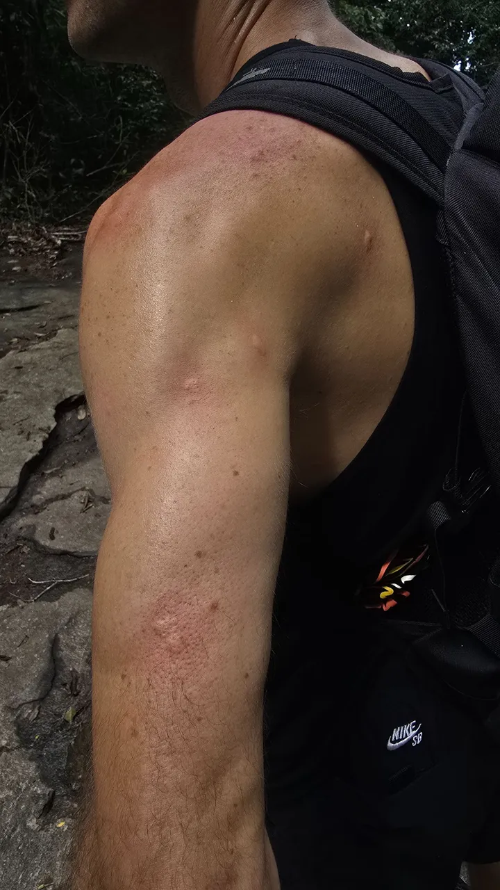 my gringo arms were a nice brunch for the brazilian mosquitos