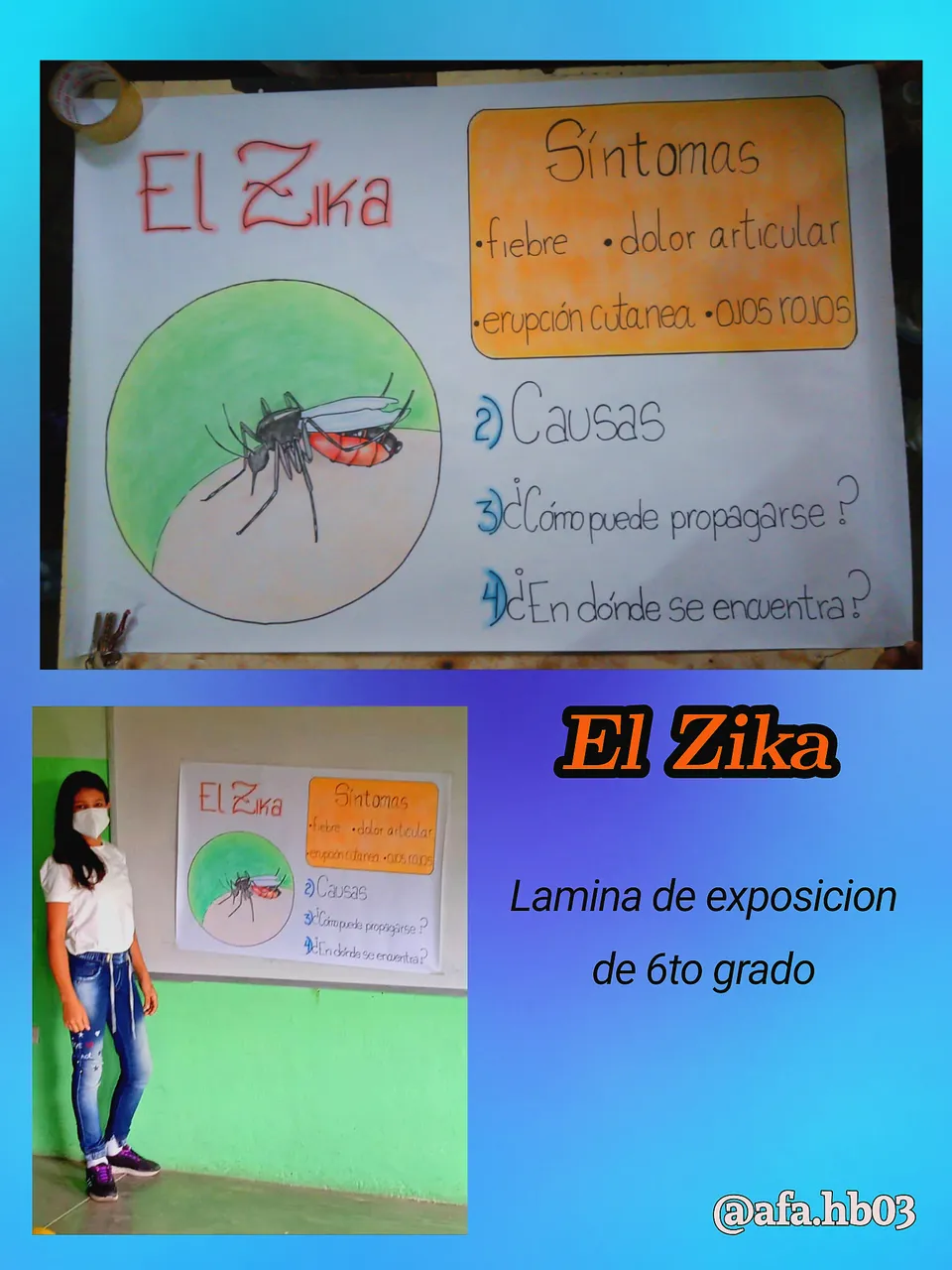 Zika.png
