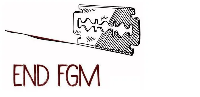 fgm.png