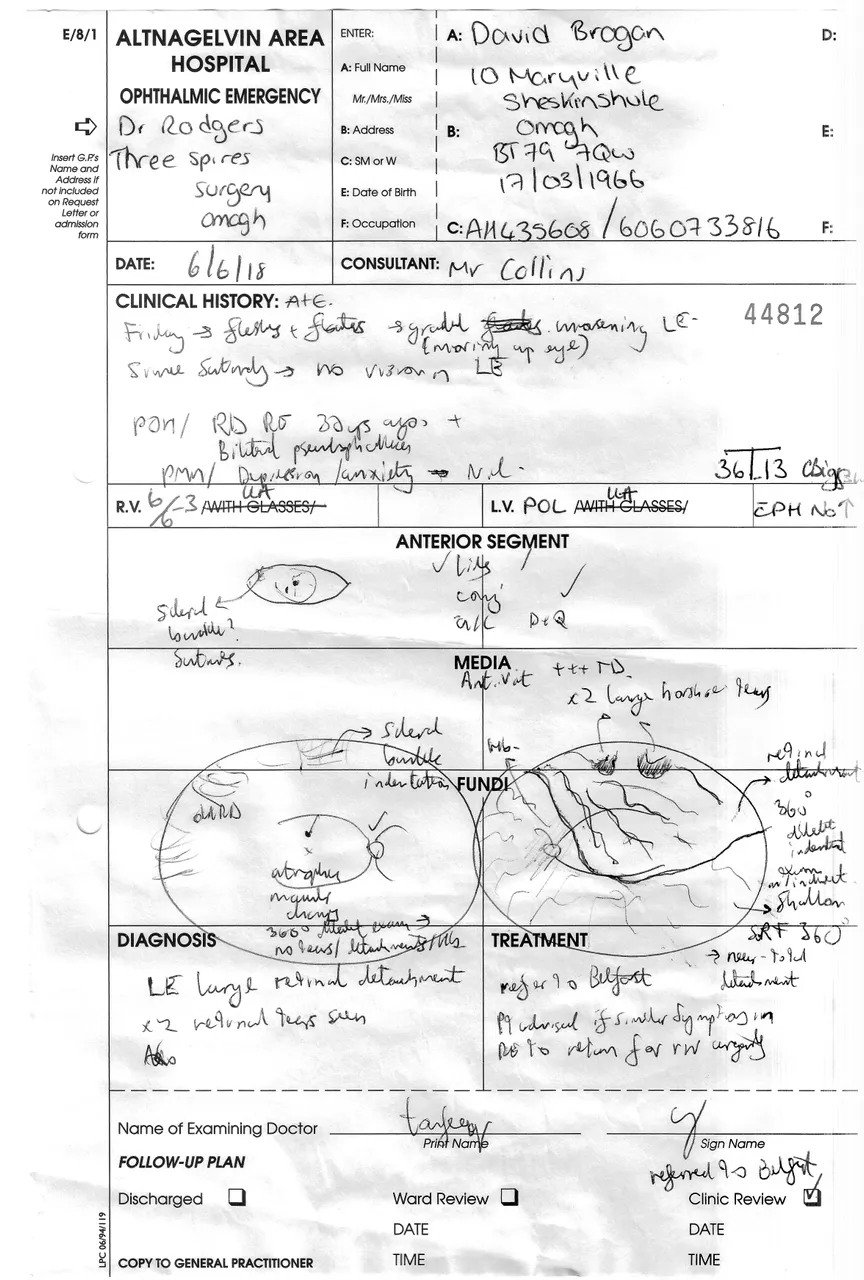 David Brogan Retinal Detachment Left Eye.jpeg