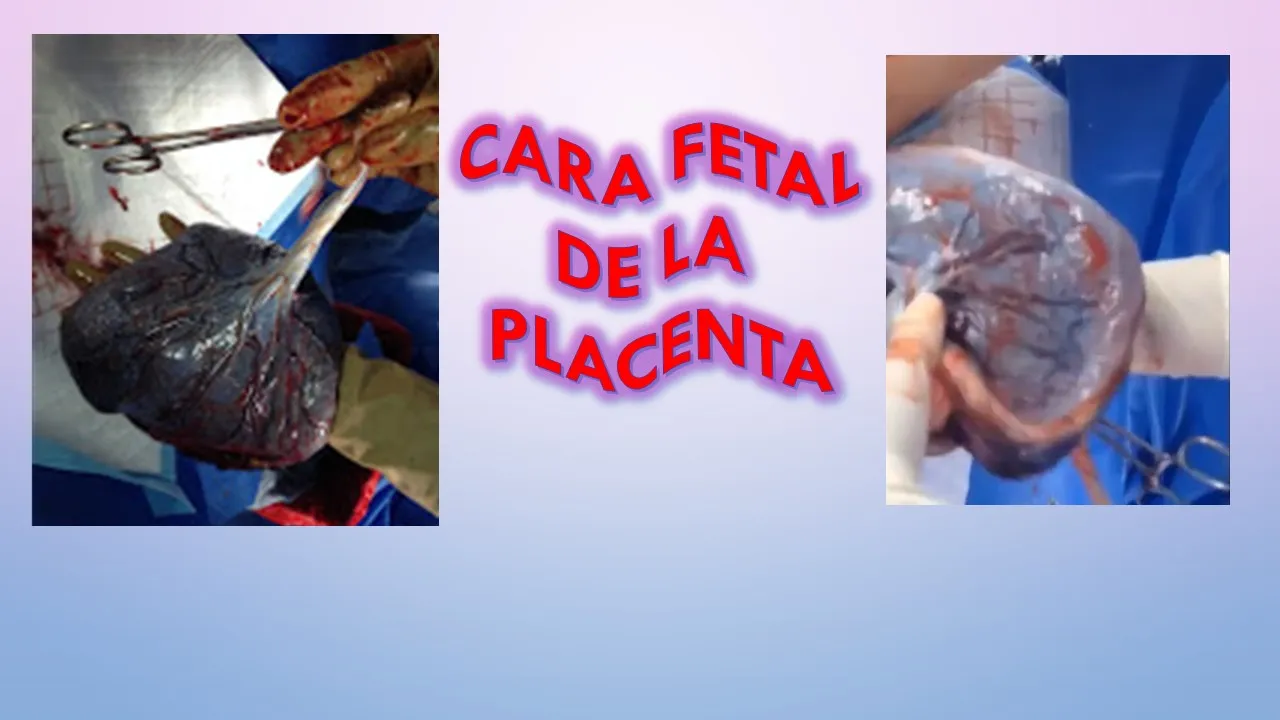 PLACENTA12.jpg