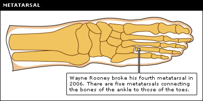 metatarsal.png