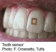 toothsensor_sm.jpg