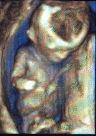 ezgif.com-crop.gif