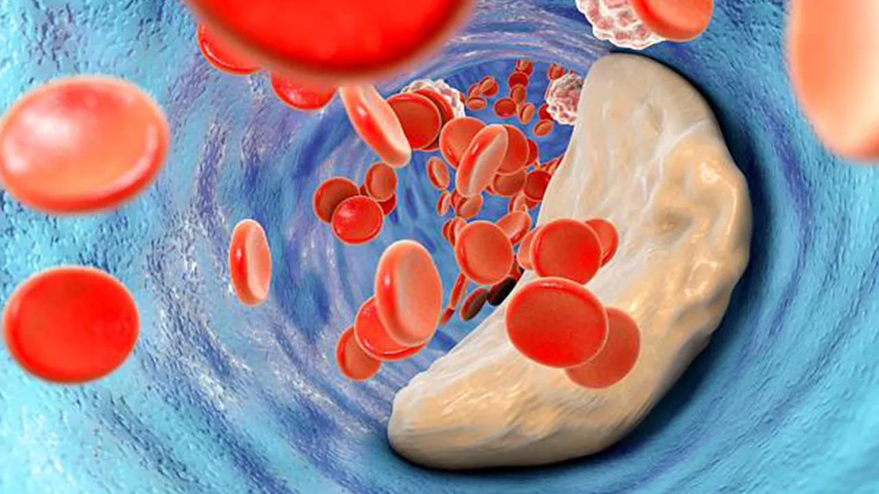 wbz-cholesterol-tests.jpg