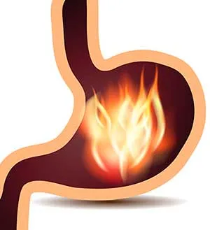 gastritis-erosiva-antral1.jpg