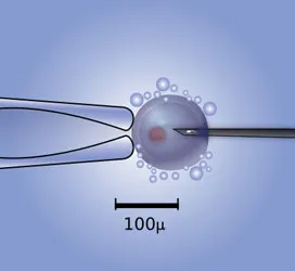 416px-Microinjection_of_a_human_egg-.jpg