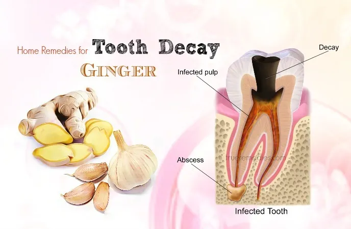 home-remedies-for-tooth-decay-ginger.jpg