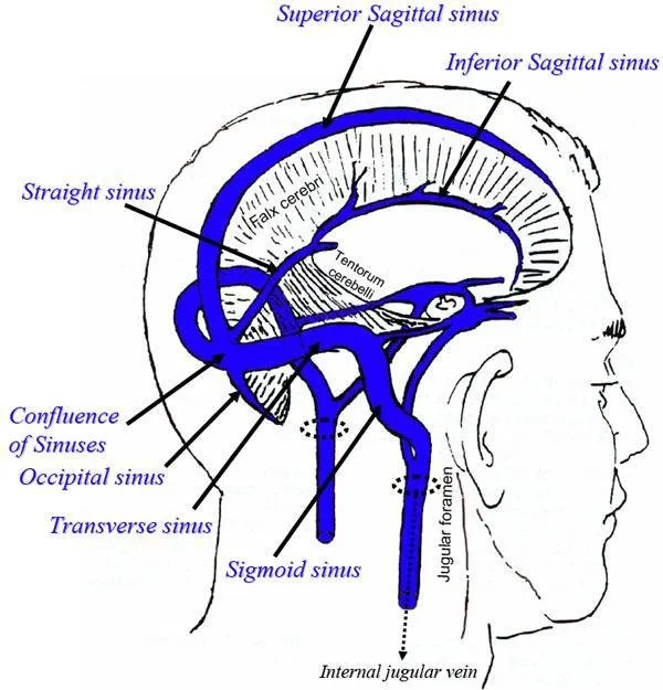 dural_sinuses1329186010315.jpg