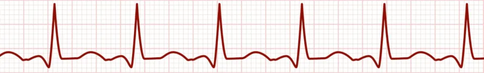 Heartbeat-Background-123RF-Crop-1800-1024x448.png