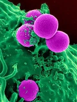 white-blood-cell-543471__340.jpg