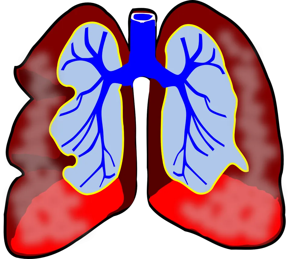 lungs-39981_1280.png