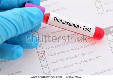 stock-photo-blood-sample-with-requisition-form-for-thalassemia-test-728417947.jpg