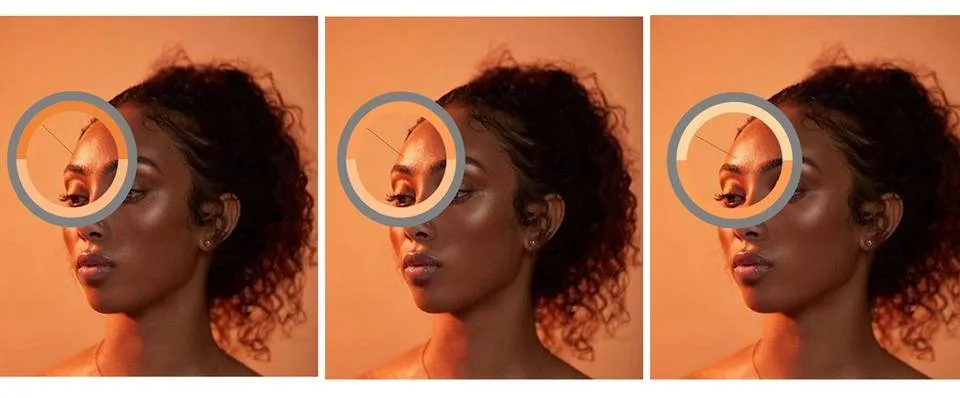 forhead.jpg