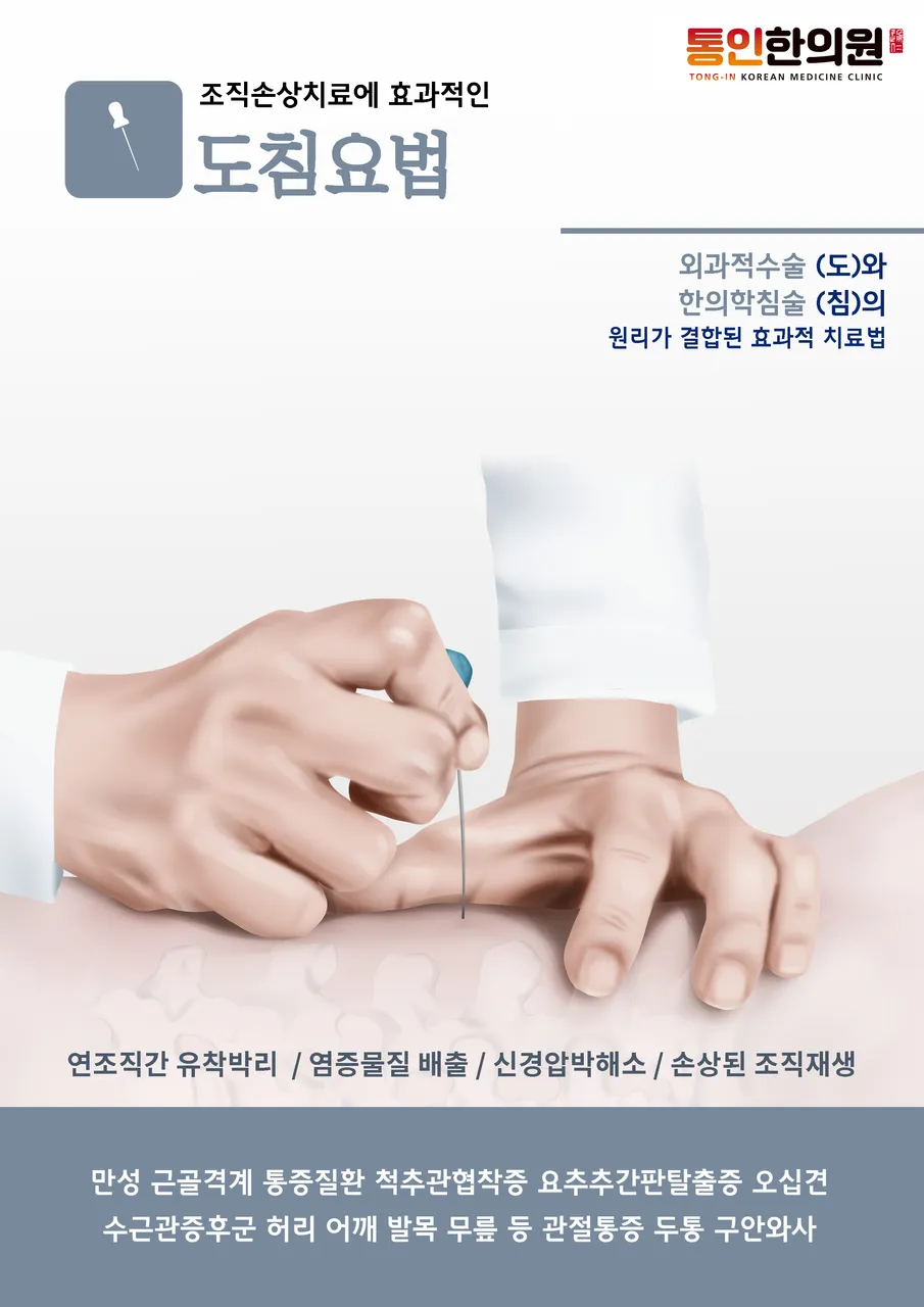 도침요법 - 종로한의원 통인한의원.jpg