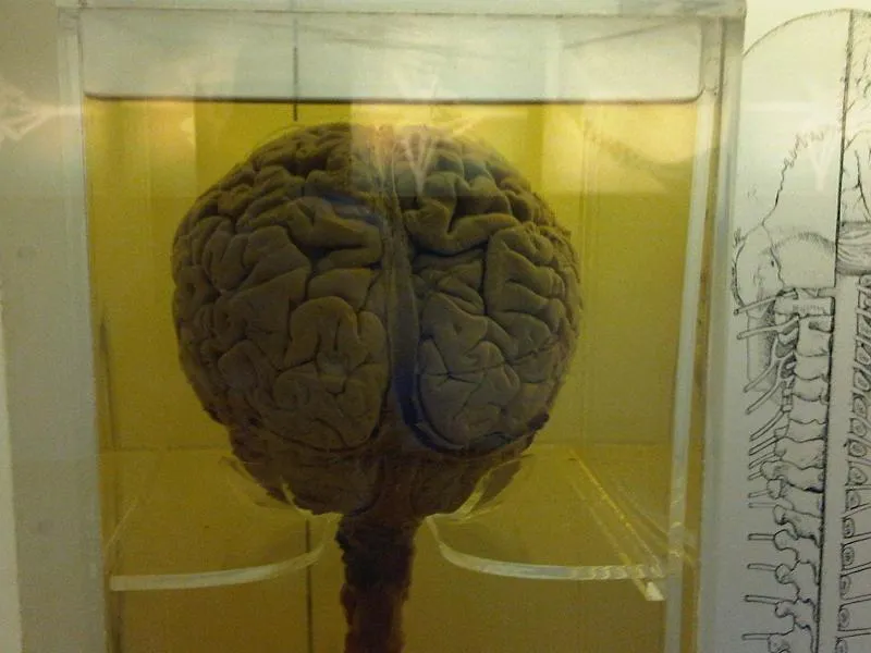 NHM_-_Brain_2.jpg