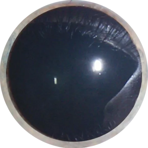 dilated eye.png