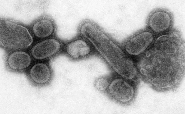 spanish-flu-virus.jpg