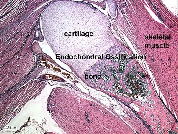 Endochondral_bone.jpg
