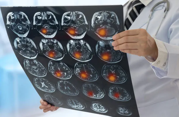 istockphoto-821471224-612x612.jpg