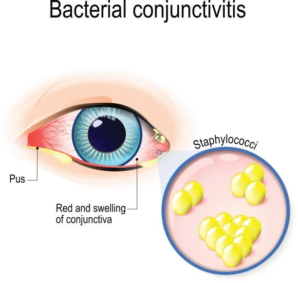 istockphoto-684137330-612x612.jpg