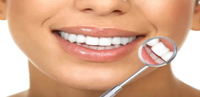 tooth-whitening(bleaching)-001.jpg