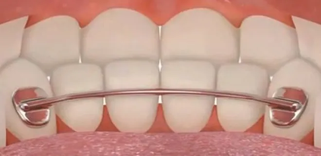 Other Treatment Stage