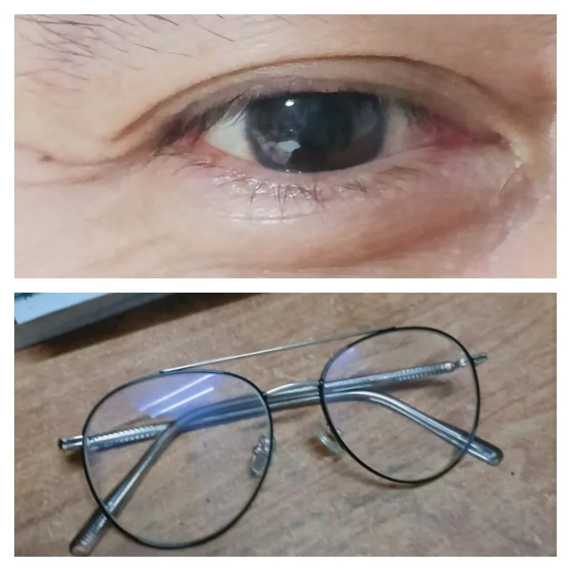 eyeglasses.jpg