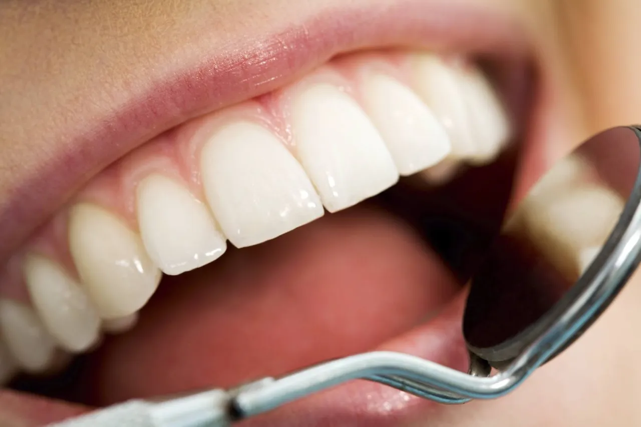 healthy-mouth-dental-dentist-teeth-gums.jpg