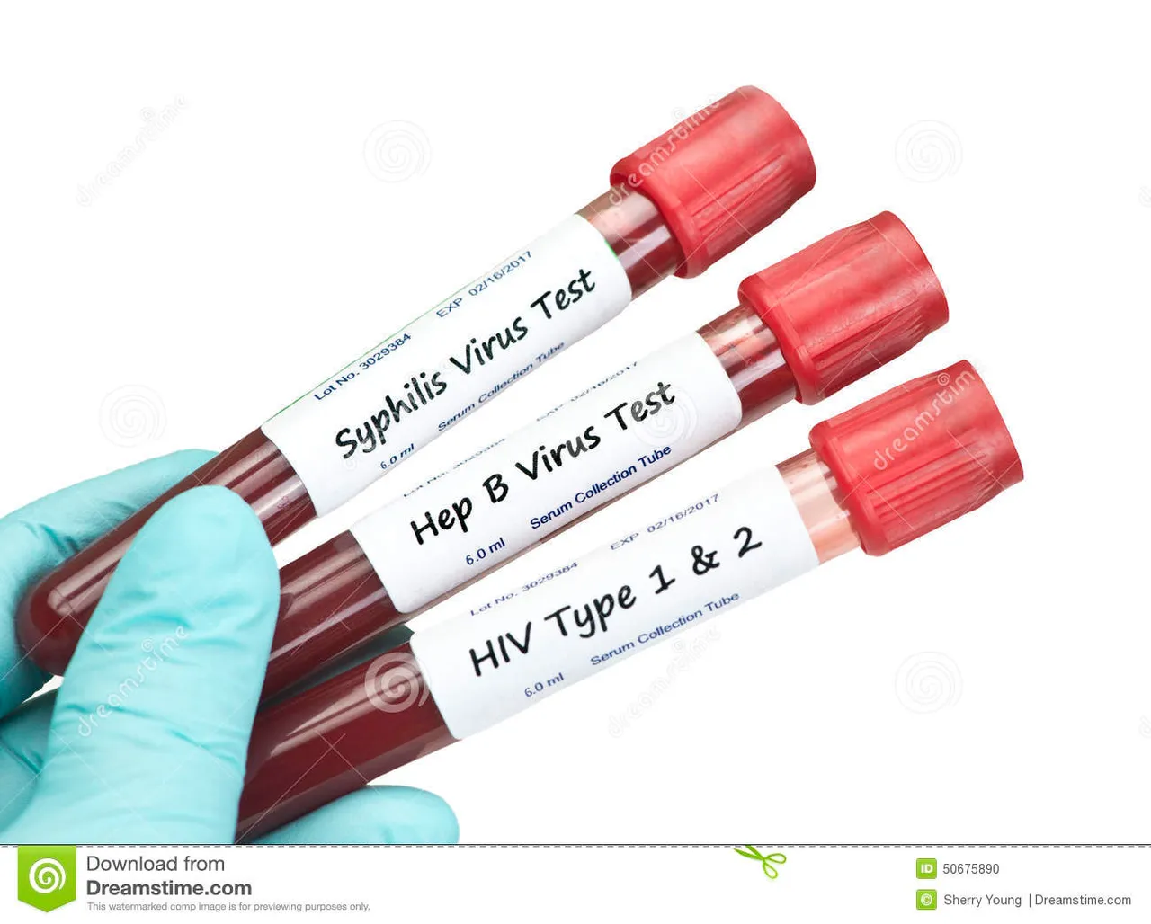 std-blood-tests-syphilis-hiv-hepatitis-b-virus-sample-collection-tubes-held-technician-labels-fictitious-serial-numbers-50675890.jpg