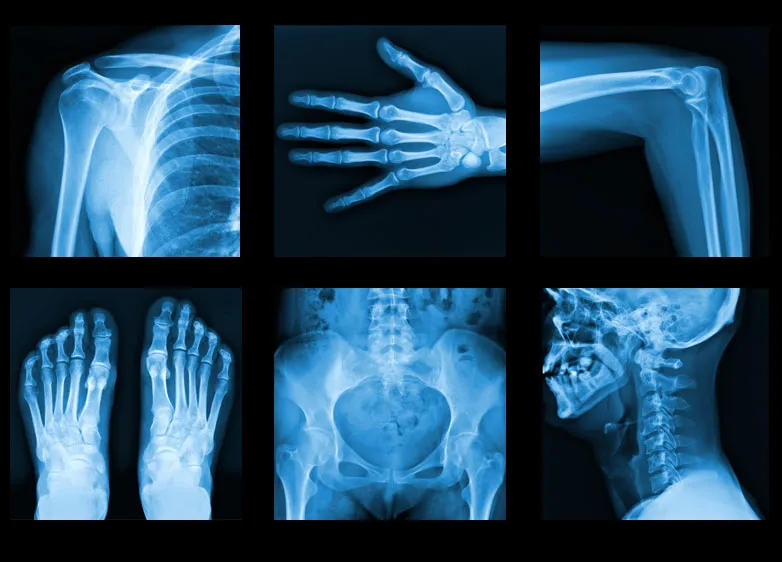 xrays.jpg