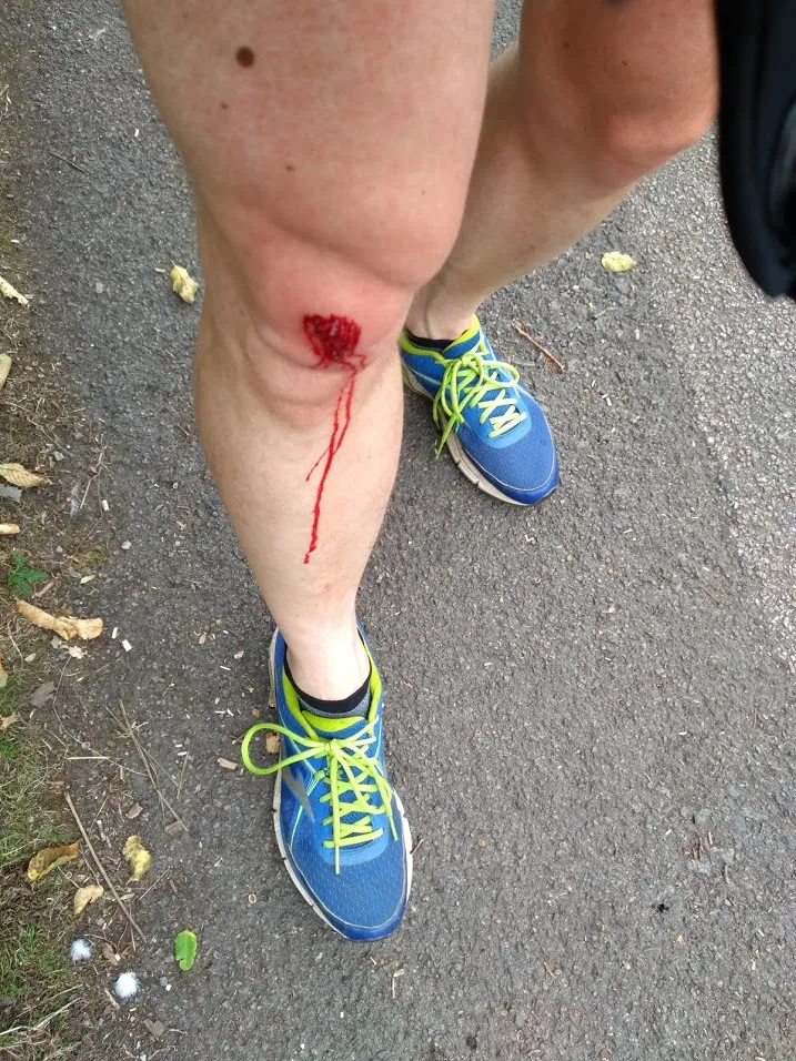 Knee