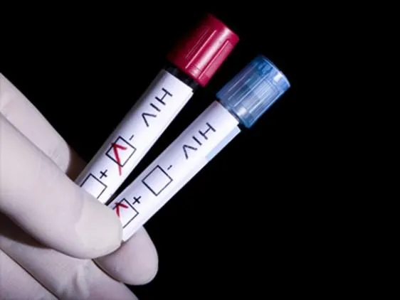 HIV-Test2.jpg