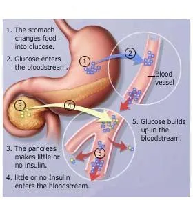 diabetes1.jpg