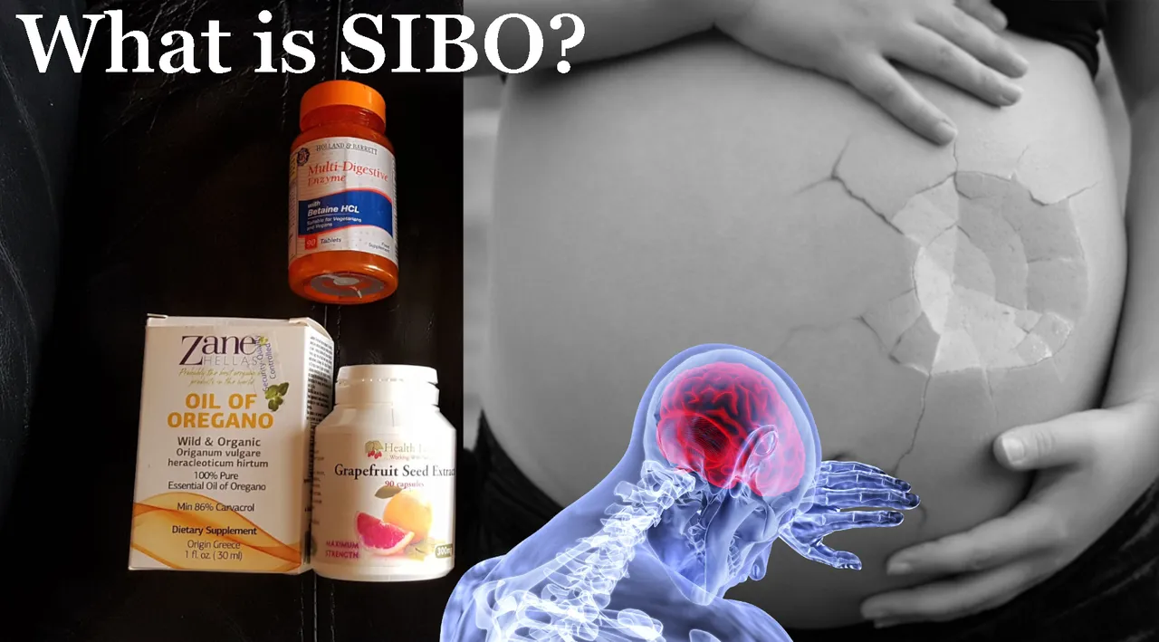 What is SIBO.png