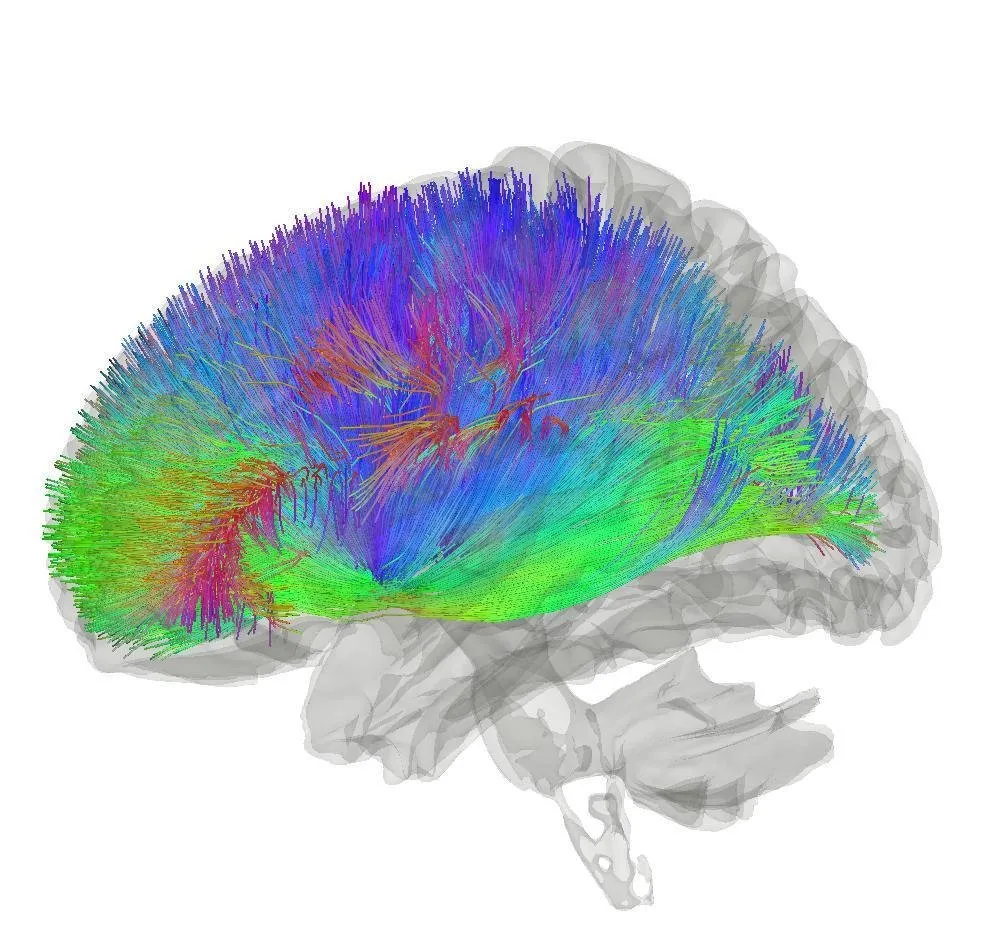 Image of Brain Neural Connections