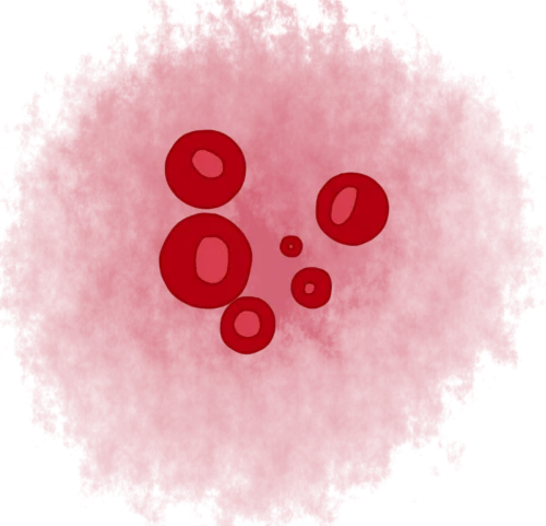 dibujo anemia (1).png