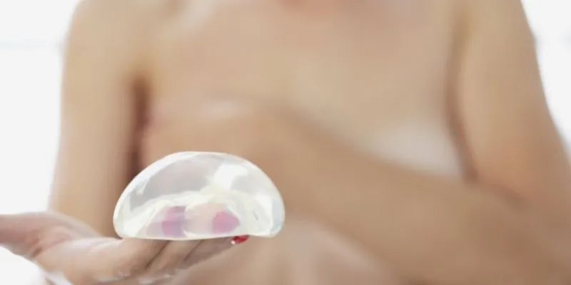 Saline and Silicone Breast Implants (1)
