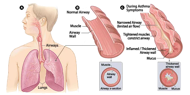 Image of Lungs
