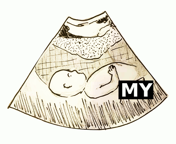 c314da7838b19491d0ef4eea16ab58c6.gif